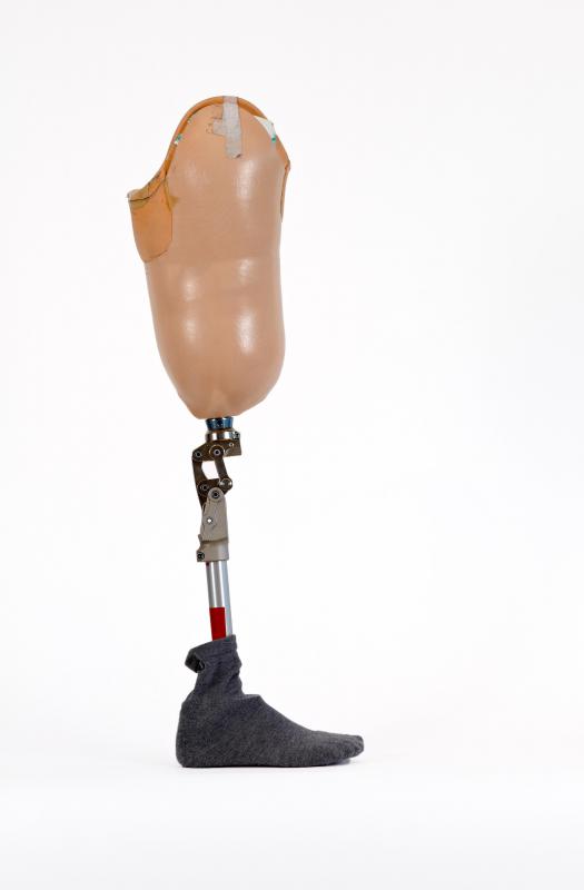 A prosthetic leg is an artificial limb that may be attached where a leg has been amputated.