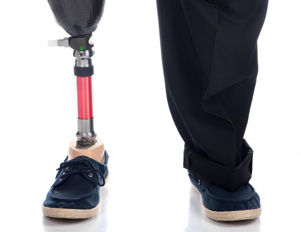 Someone who has lost a leg can walk again using a prosthetic limb.