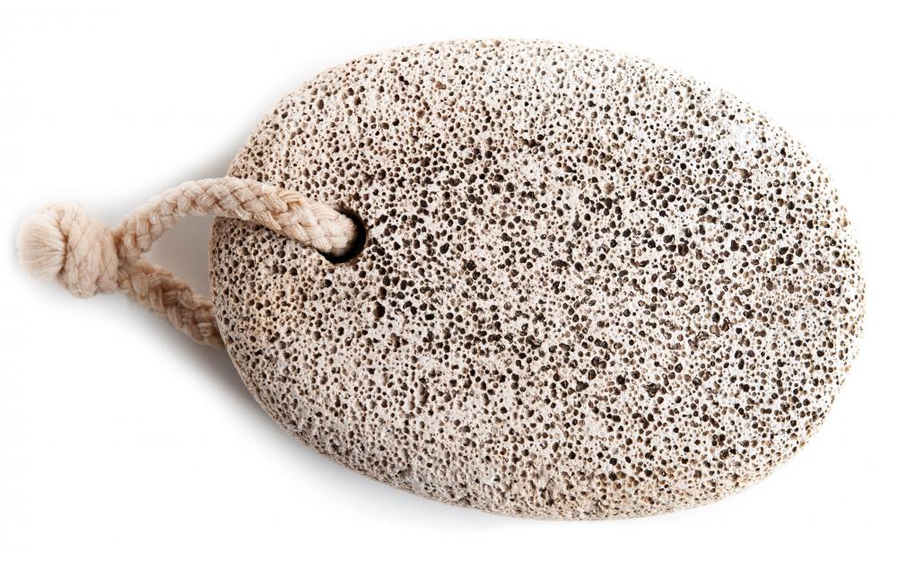 A pumice stone, which can be used to file warts down.