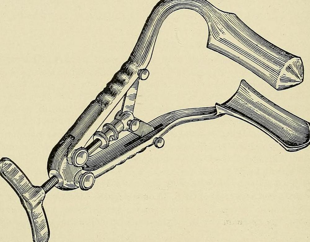 A rectal speculum may be made of metal or a very tough plastic.
