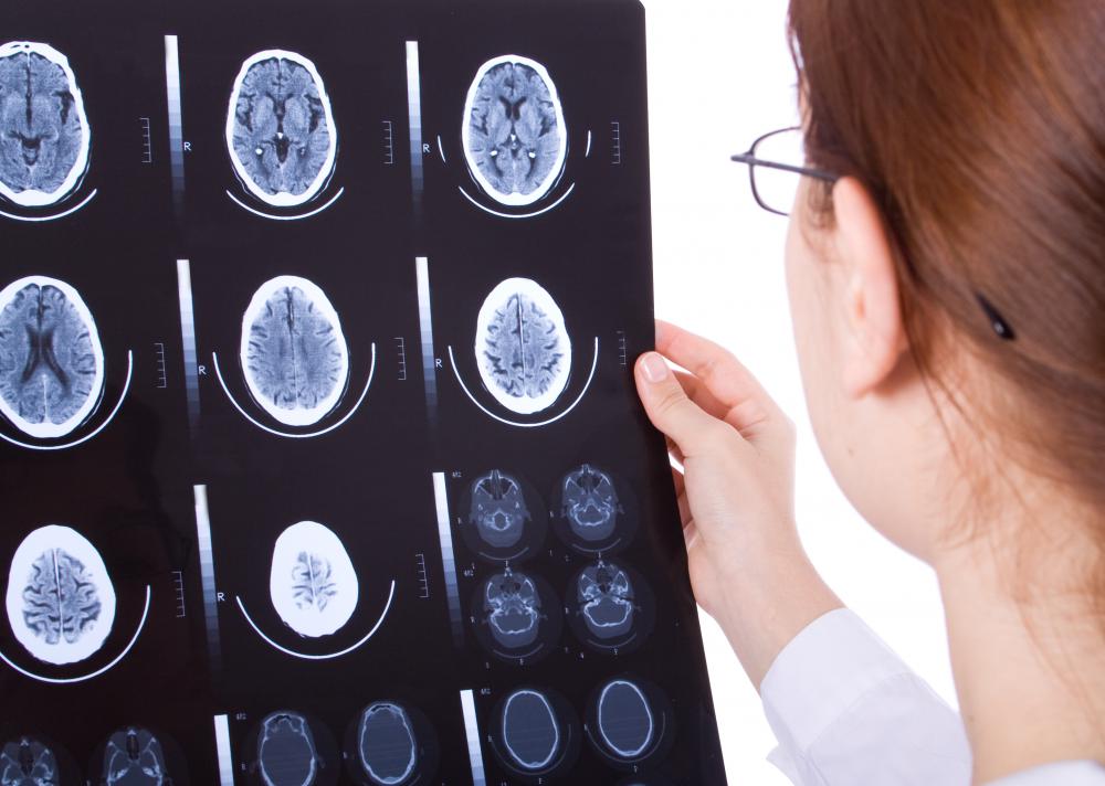 PET scan results may be studied to look for brain abnormalities.