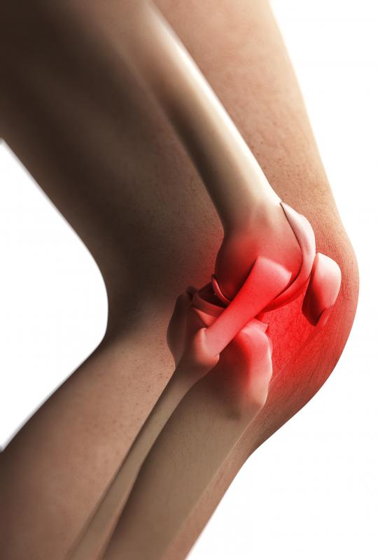 Bursitis may affect joints that move repetitively, such as the knee.
