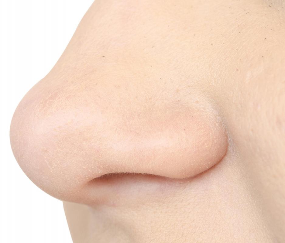 A nasogastric tube is run through a patient's nose and into his or her stomach.