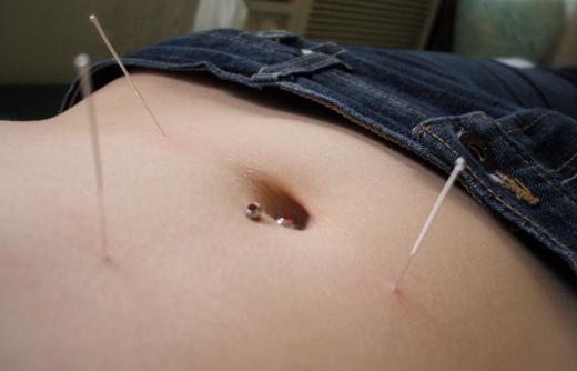 Acupuncture meridians are also used in acupressure and tapping therapies.