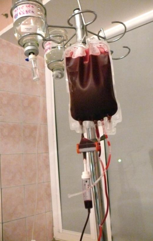 Blood transfusions may be part of the management of genetic disorders involving large platelets.