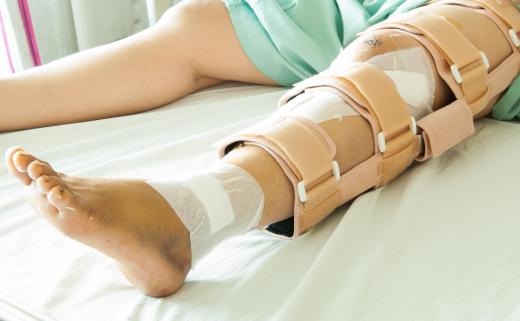 A rigid splint can be used to immobilize the leg.