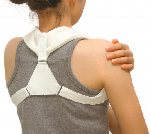 A clavicle brace may be used to provide support and stability for the collarbone after a fracture.