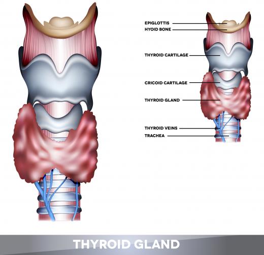 Hyperthyroidism may create higher levels of beta-keto acids in the body.