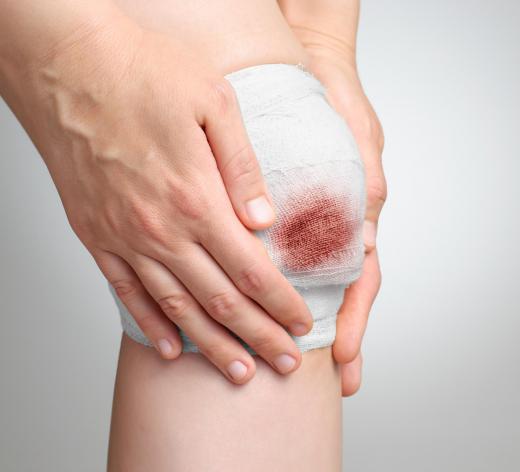 A wound care specialist may evaluate a patient to determine the best care options.
