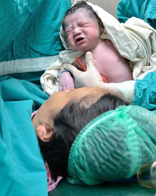 Delivery of the placenta typically occurs about 15 to 30 minutes after birth.