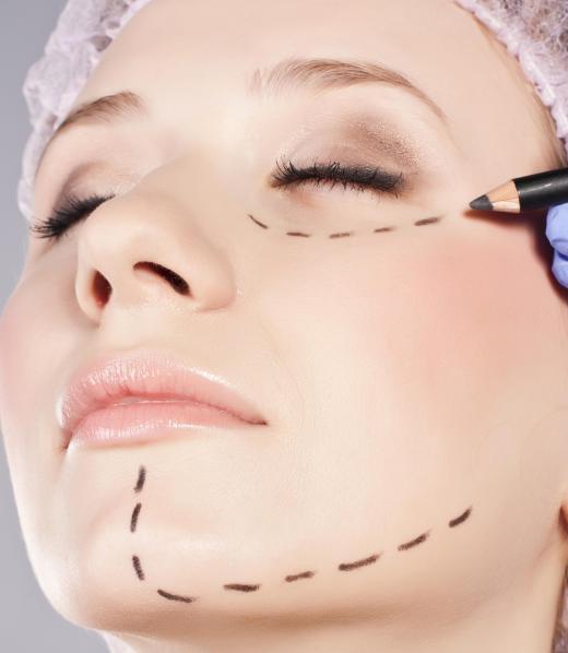 Women often have cosmetic plastic surgery in the eye, nose and chin areas.