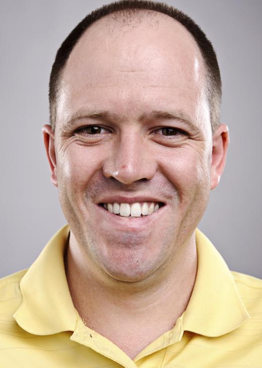 Hair thinning is a possible side effect of gold therapy.