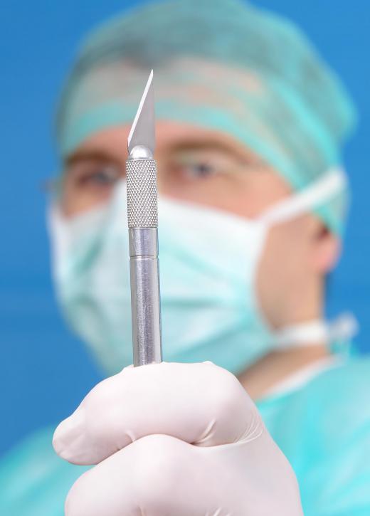 A canthoplasty can be performed for purely cosmetic purposes.