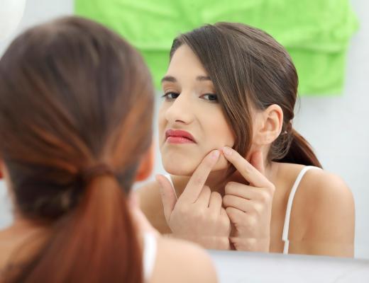 Sulfur ointment is used to clear blackheads and other blemishes.