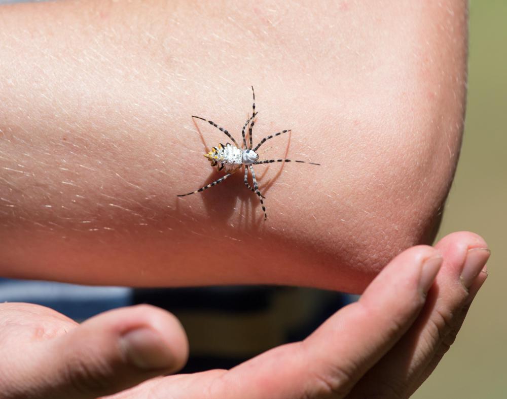 Many spider bites go unnoticed or cause only minor irritation -- unless a person is allergic to spider venom or the venom is poisonous.