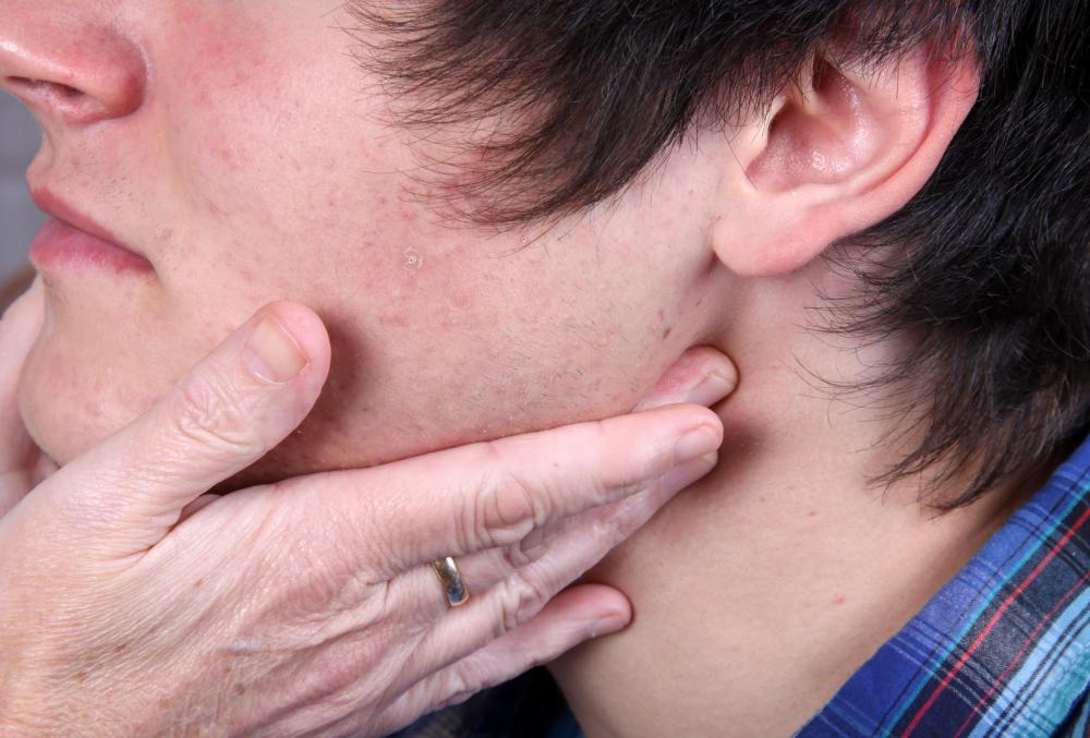 Any concerns about a sexually transmitted disease should only be addressed by a trained medical professional.