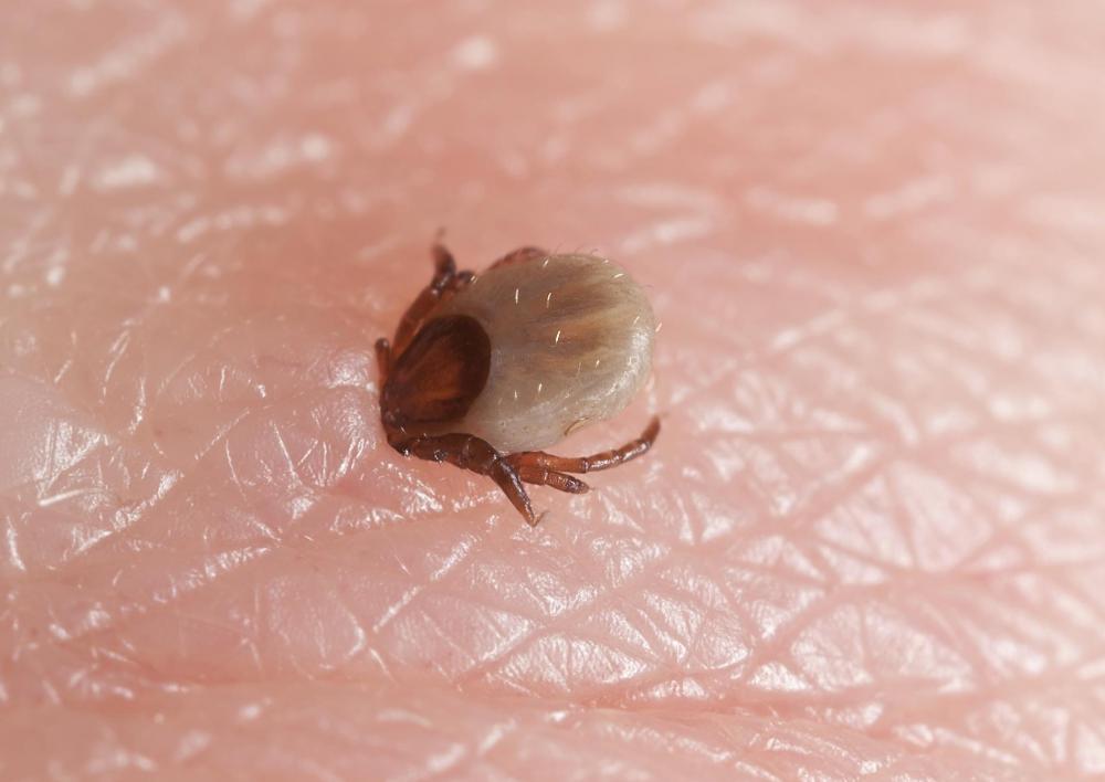 Tick bites may blister within a few days of occurring.