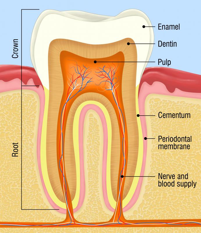 Tooth resorption can often lead to a dentist performing a root canal.