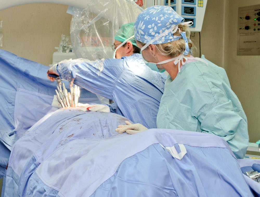 Treatment for a serious adnexal mass may include surgery.