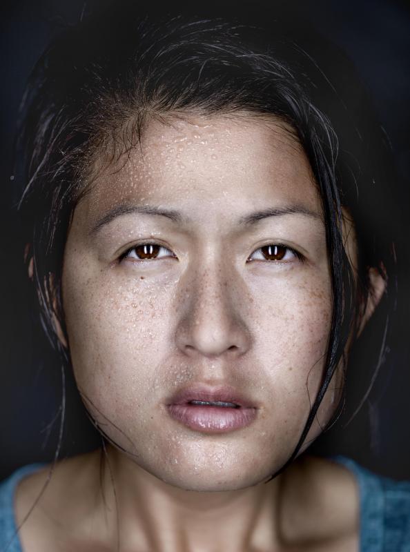 Sinusitis may cause facial swelling.