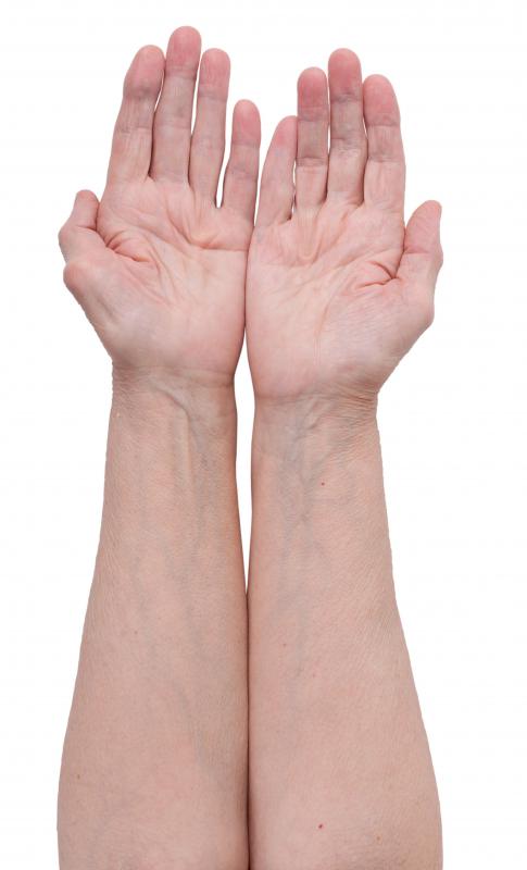 A person with visible blood vessels, which are part of the circulatory system.