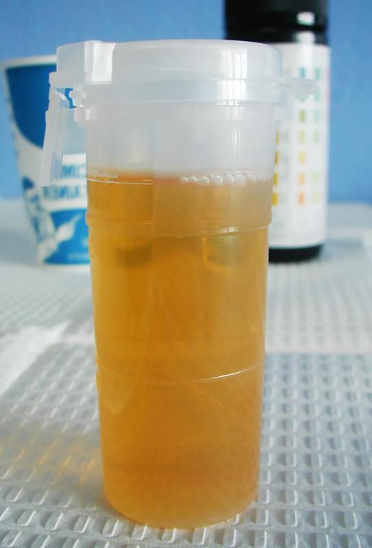 A urinalysis may be conducted to check for markers indicative of the presence of infection.