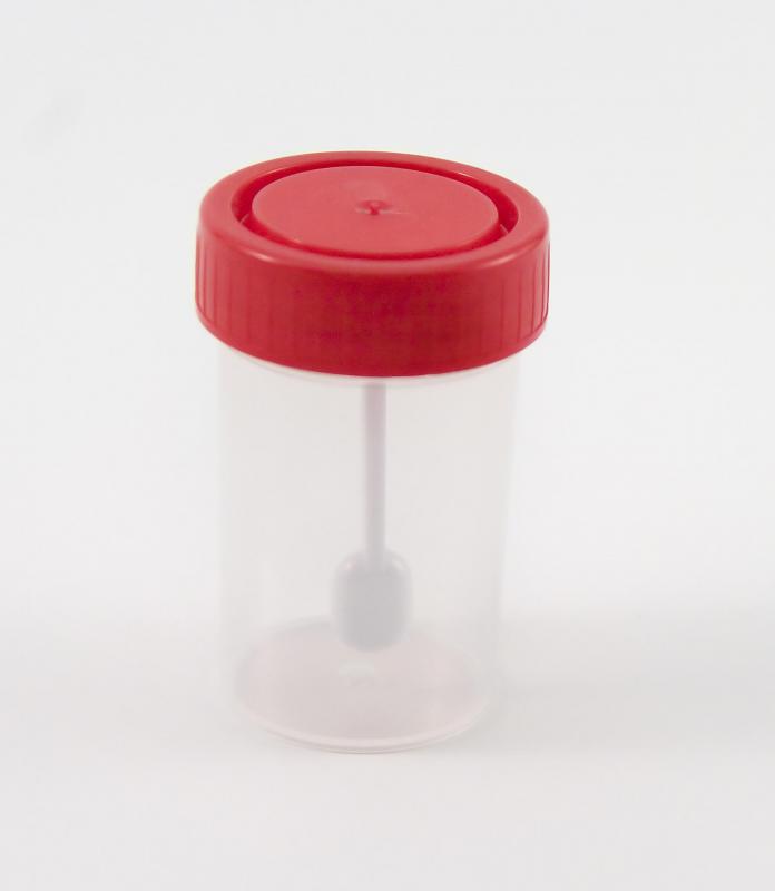 Bloody urine may be a side effect of naproxen and aspirin.