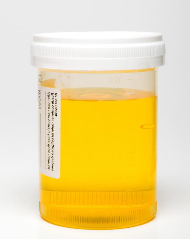 Glucose is not naturally present in the urine.