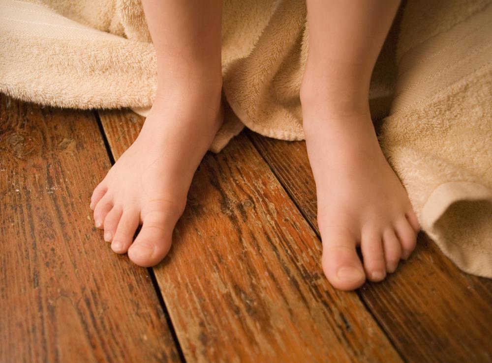 Someone who steps on a cold surface may experience a cold burn.