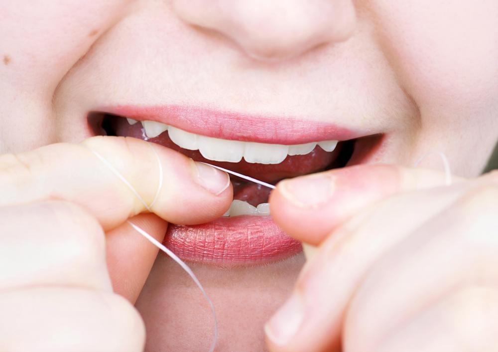Continue flossing even if gingivitis is present in the gums.