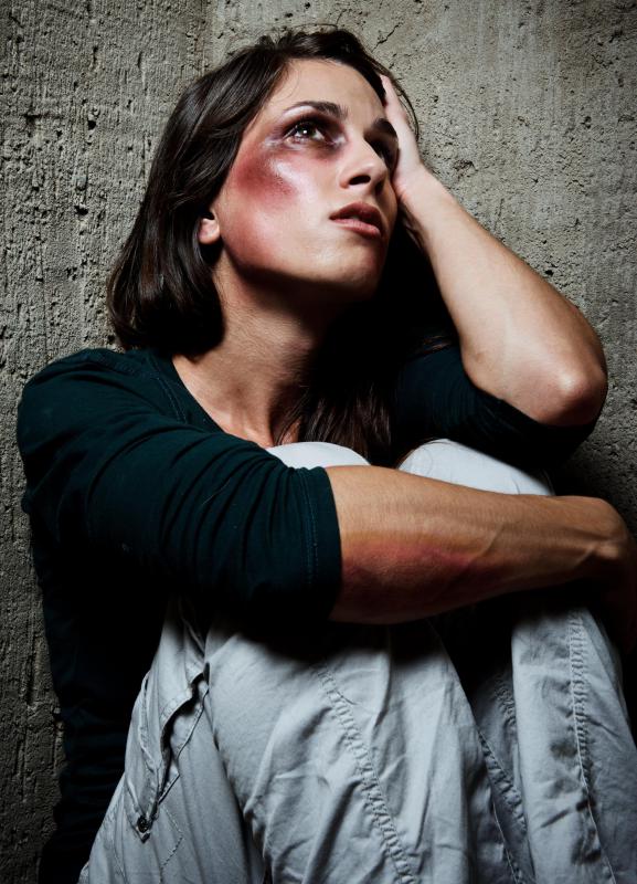 A person suffering from domestic abuse often believe they deserve the treatment.