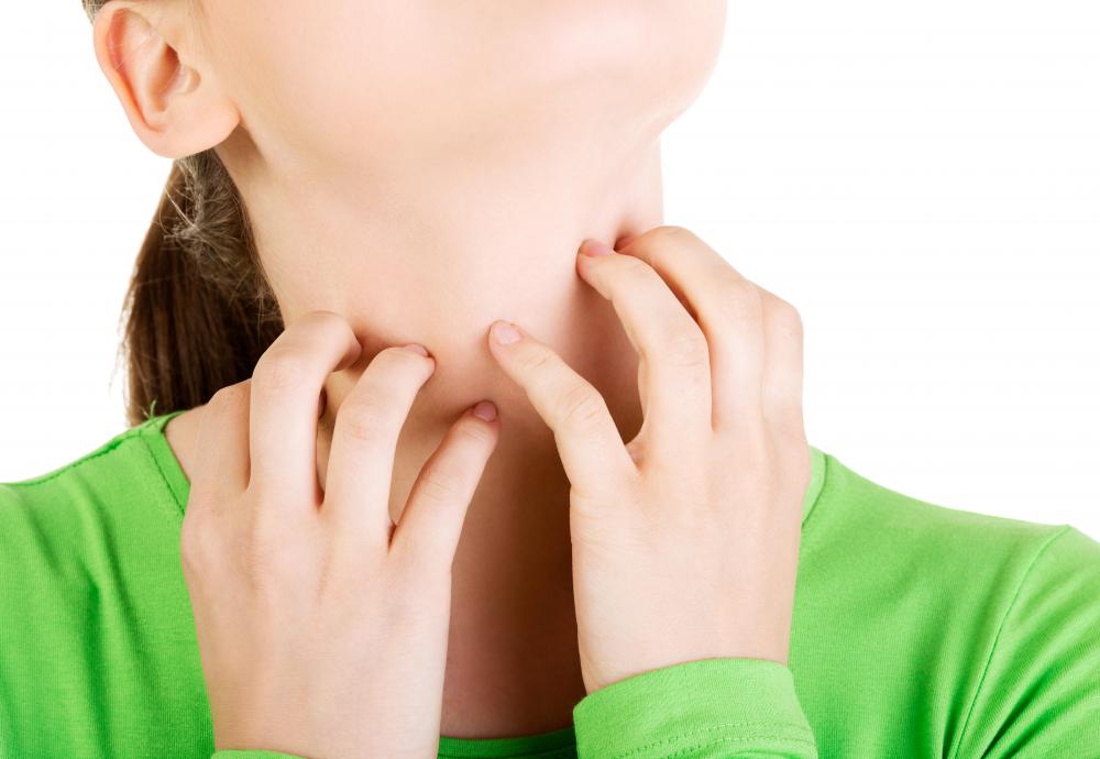 Eczema can cause itching in several locations, including the neck and face.