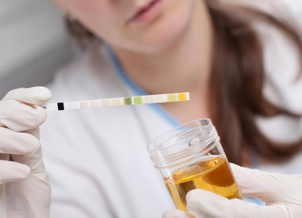 The distal convoluted tubule helps regulate the pH of the urine by secreting positively charged protons.