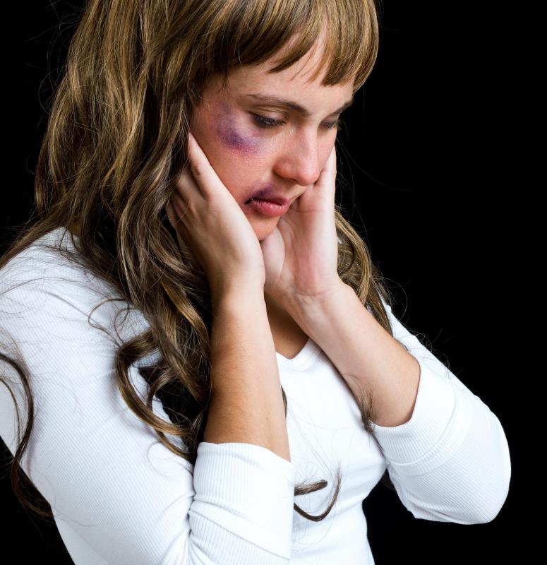 Trauma to the face may lead to the development of a petechial rash.