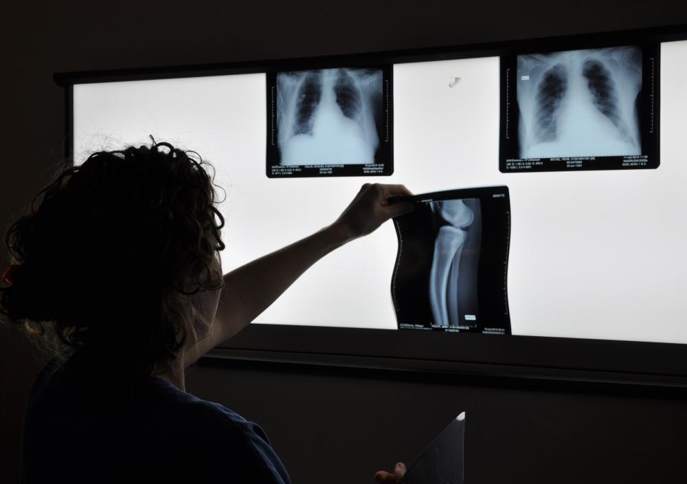 Medical imaging studies may be conducted in order to diagnose an epithelial neoplasm.
