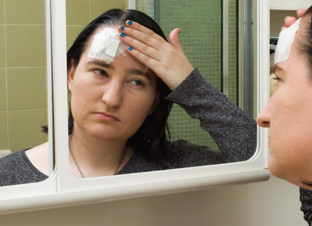It is possible to make an effective bandage for the forehead using guaze.