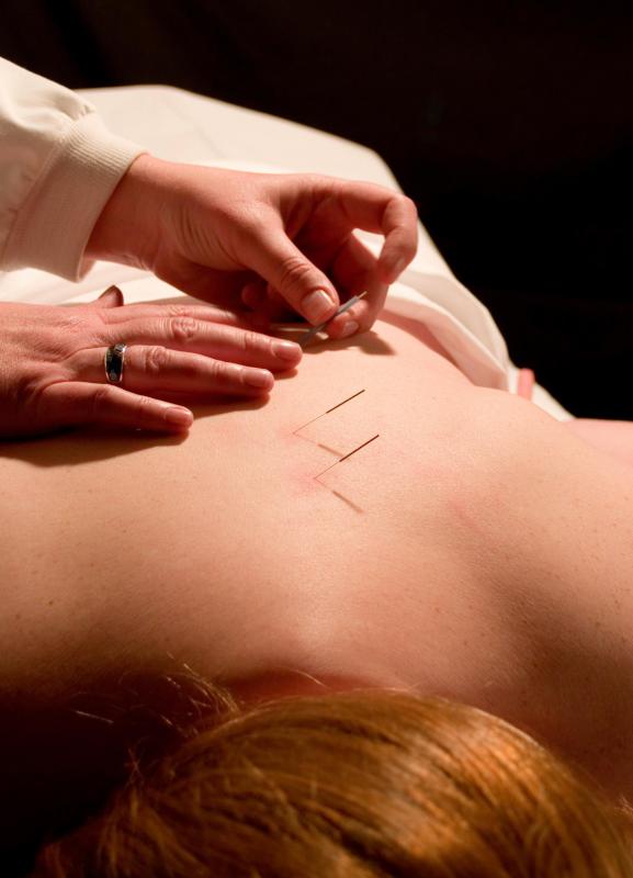 Eastern medicine relies on traditional and alternative remedies such as acupuncture to treat conditions.
