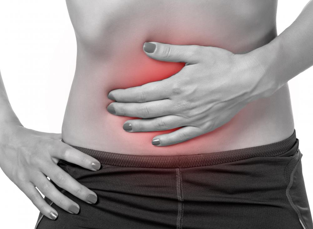 Incarcerated hernias are a type of strangulated hernia that usually involves the bowels, and are considered surgical emergencies.