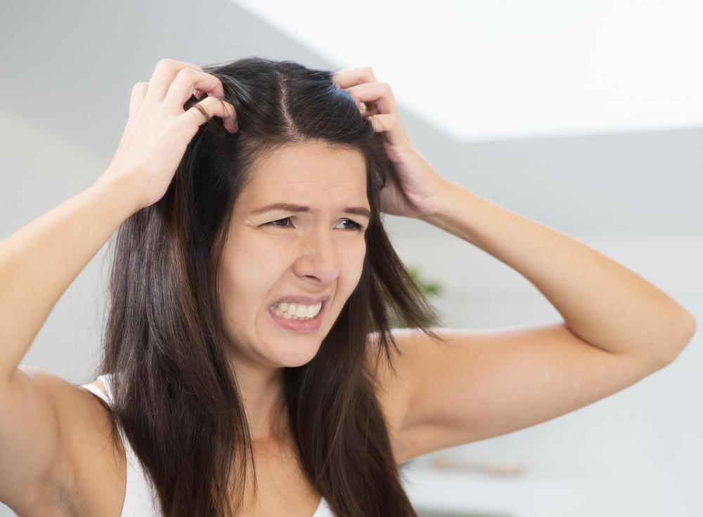 Scabies on the scalp causes severe itching that worsens at night.