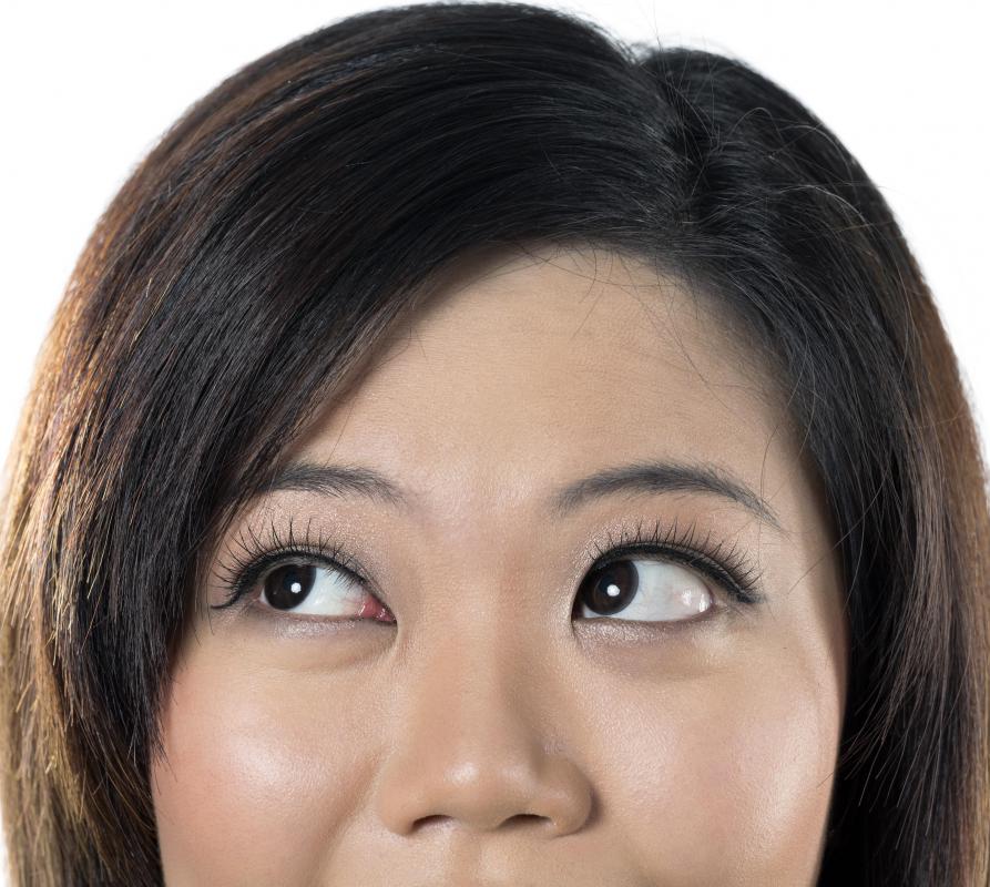 The lacrimal caruncle refers to the small triangle-shaped pink bump located in the corner of the eye.