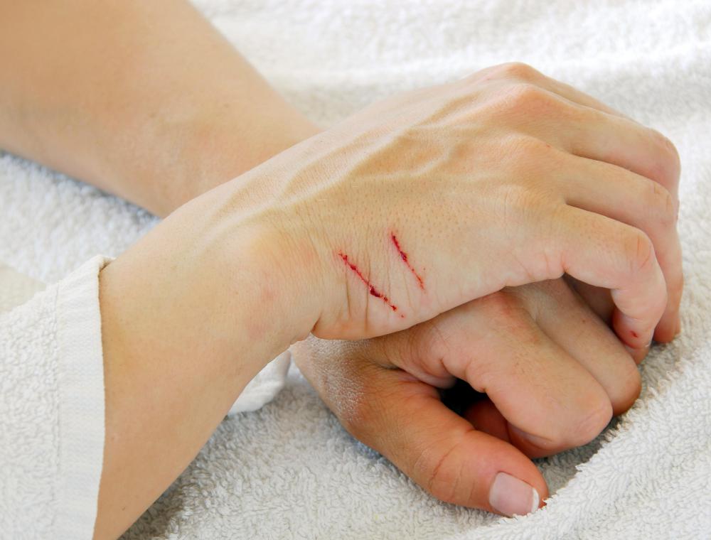 Cat scratches may cause swelling of the liver and spleen.