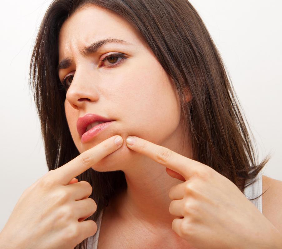 Blackheads may exhibit black pus that is caused by an infection in the pore.