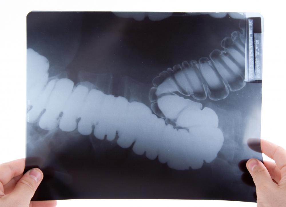 Intestinal X-rays may be used to diagnose necrotic entercolitis.