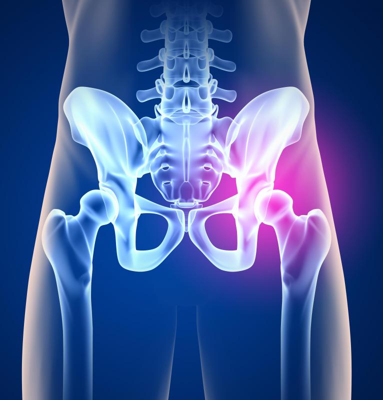 Bone islands commonly occur in the hip.