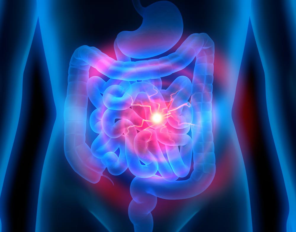 Protein intolerance can lead to permanent damage of the small intestine.