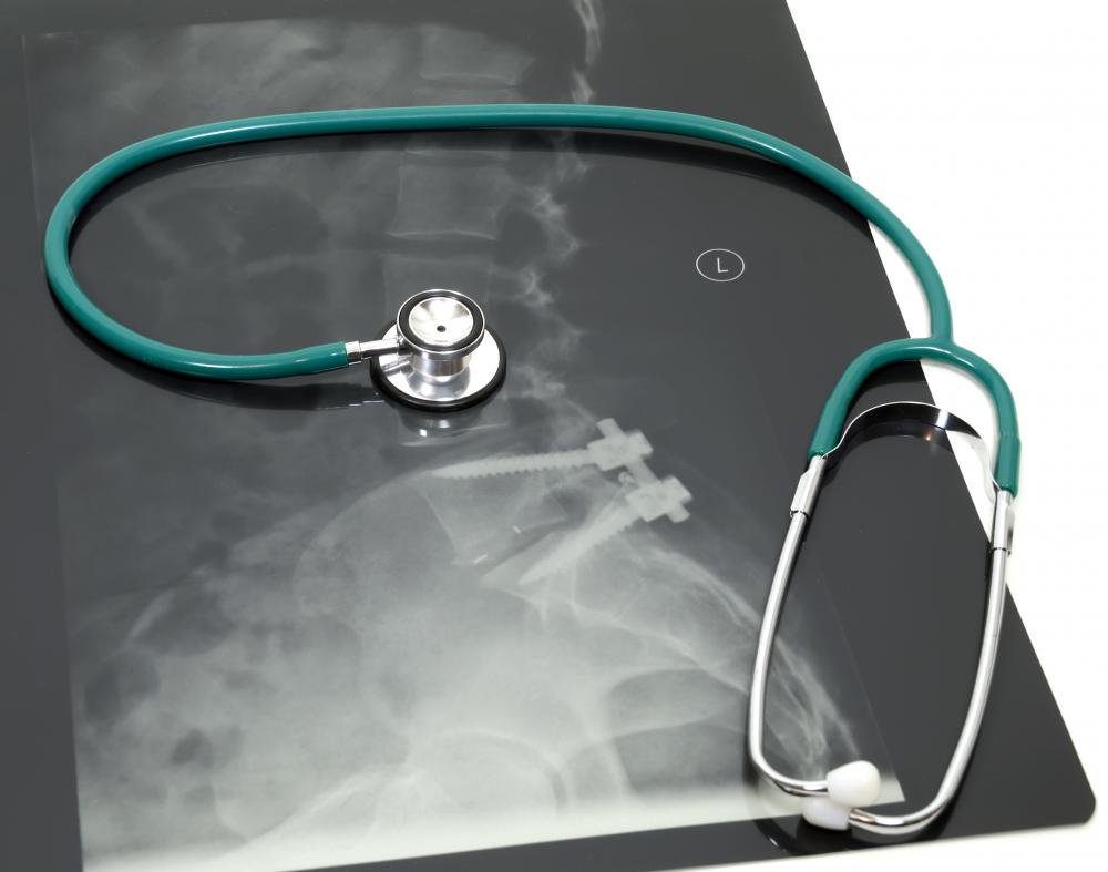 As neck lumps can range from harmless to serious, undergoing x-rays are effective means of investigation.
