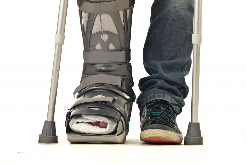 What Is an Air Cast Boot? (with pictures)