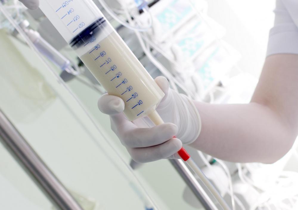 What is a Jejunostomy? (with pictures)