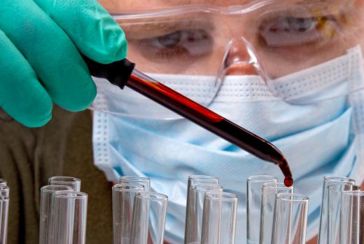 A hematologist performing tests for a platelet disorder.