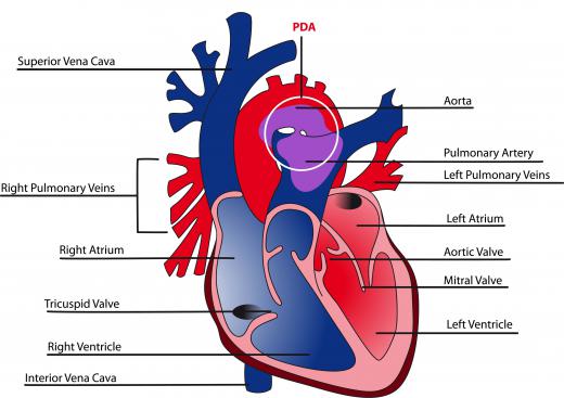 Congestive heart failure can occur as a result of prolonged high blood pressure.